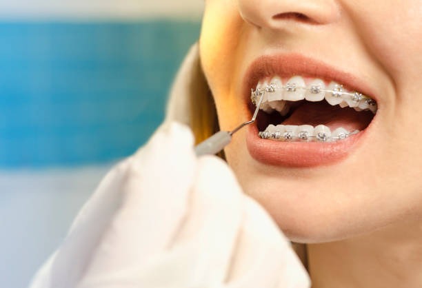 Thrive Dental and Orthodontics Emergency Dentist Dallas